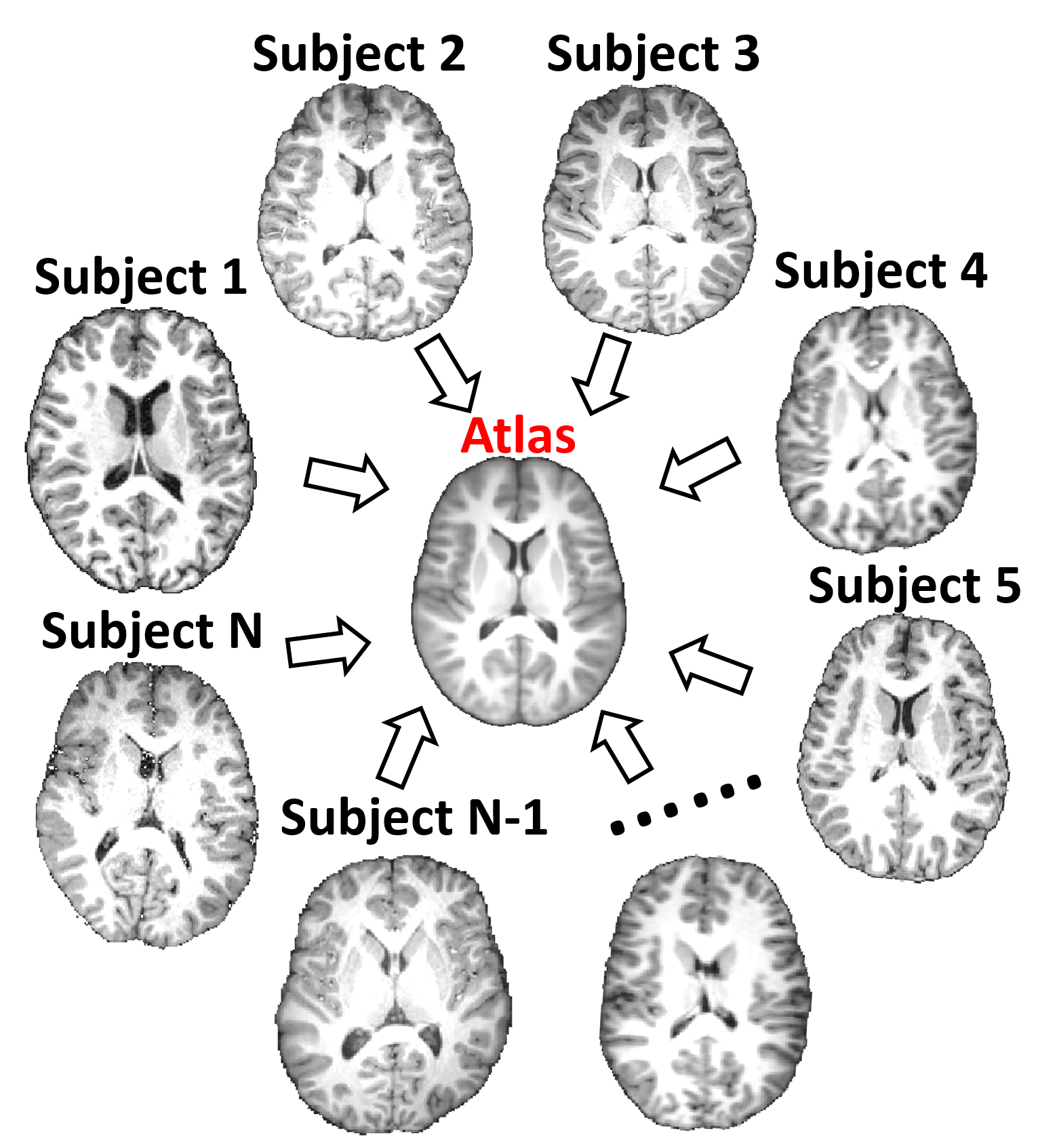 Brain Atlases | Image, Informatics & Intelligence (i3) Research Lab