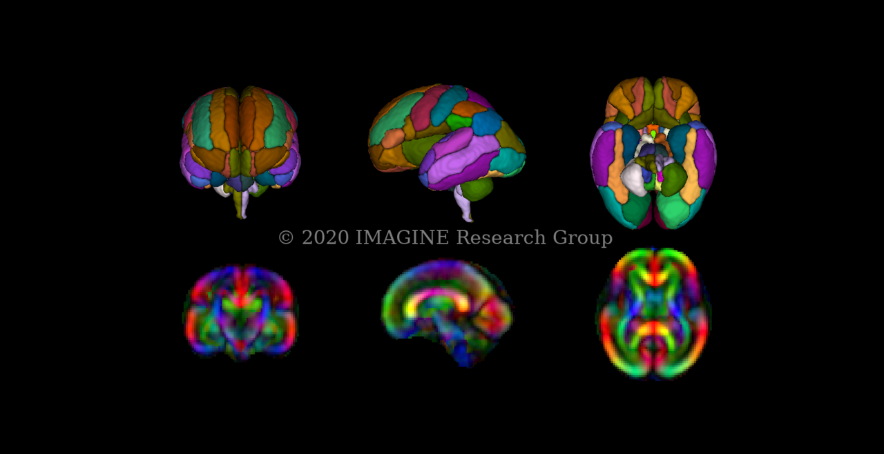 Images of the T2 and Diffusion Brain Atlases