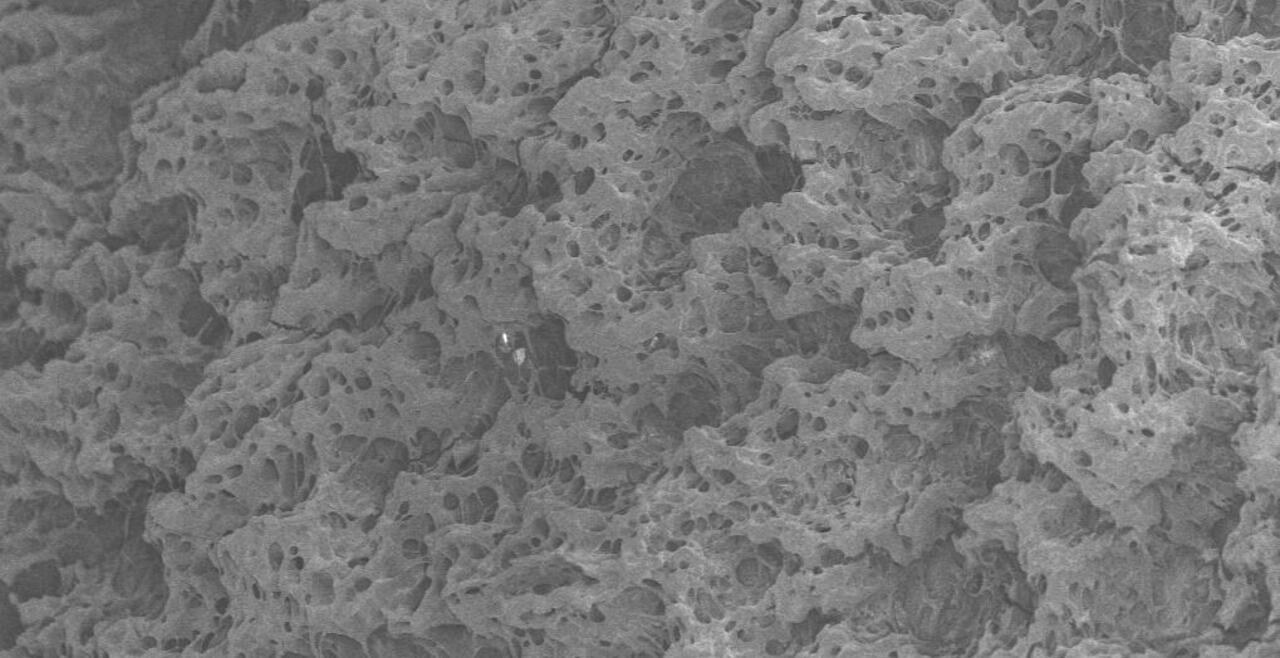 PMPC coating for anti-fibrosis