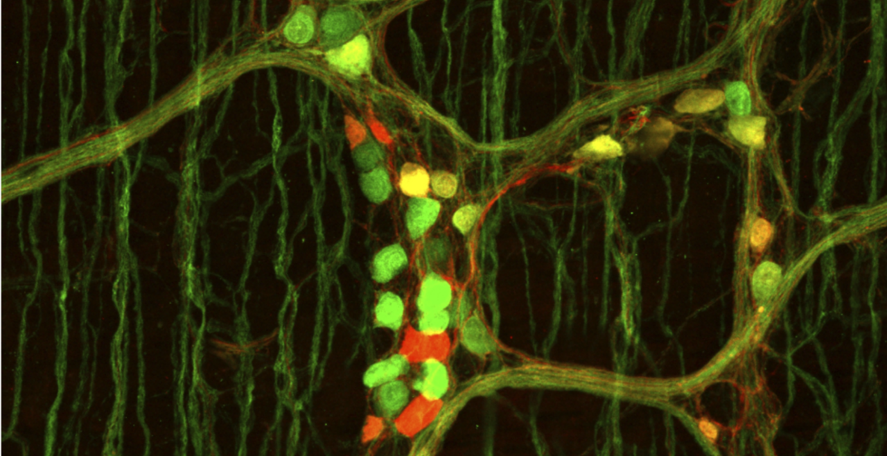 Enteric neurons in the myenteric plexus