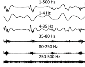signals