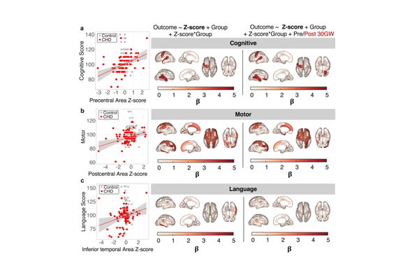  Foetal cortical expansion is associated with neurodevelopmental outcome at 2-years in congenital heart disease: a longitudinal follow-up study 